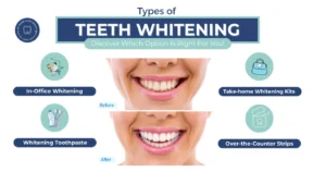 Dr. Lizette-Types of teeth