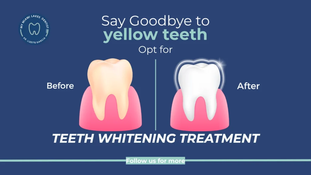 Dr. Lizette_Teeth Whitening